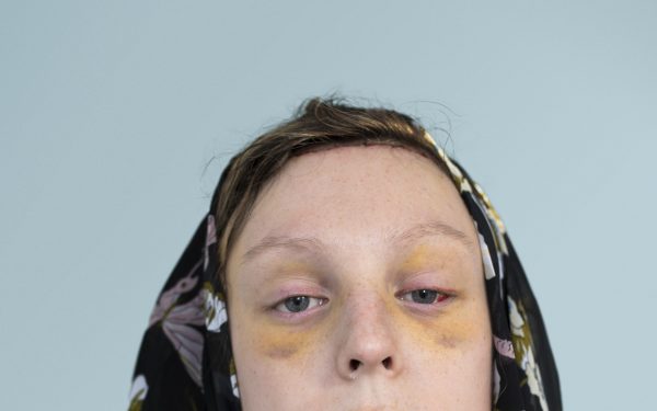 Close-ups of the loving and the political